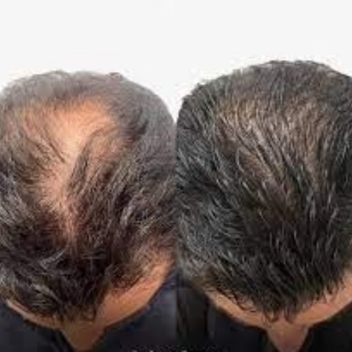 Aceite de Batana para el crecimiento del cabello 100% natural.